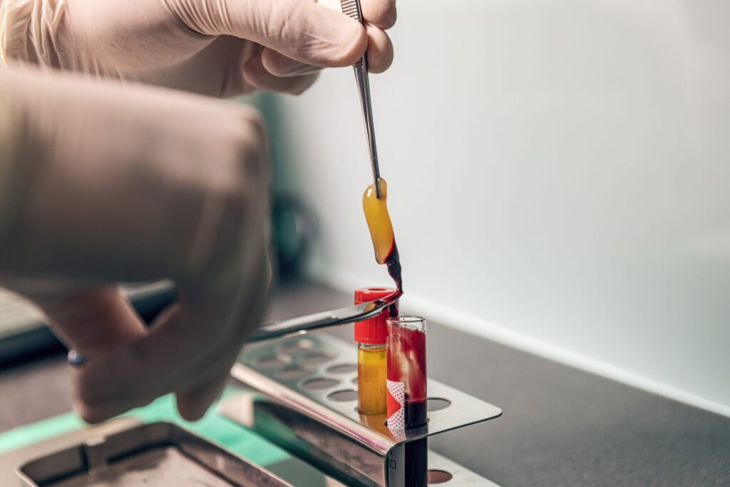 Faster Dental Healing with PRF: How Advanced Technology Supports Natural Recovery